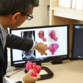 doctor; sony singh; the ottawa hospital; surgery; uterus; cancer; 3D printing; equipment; technology; women's health;
