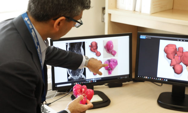doctor; sony singh; the ottawa hospital; surgery; uterus; cancer; 3D printing; equipment; technology; women's health;