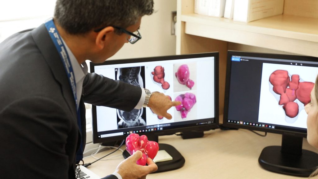 e Dr Sony Singh tient un utérus imprimé en 3D et en examine les images à l’écran.
