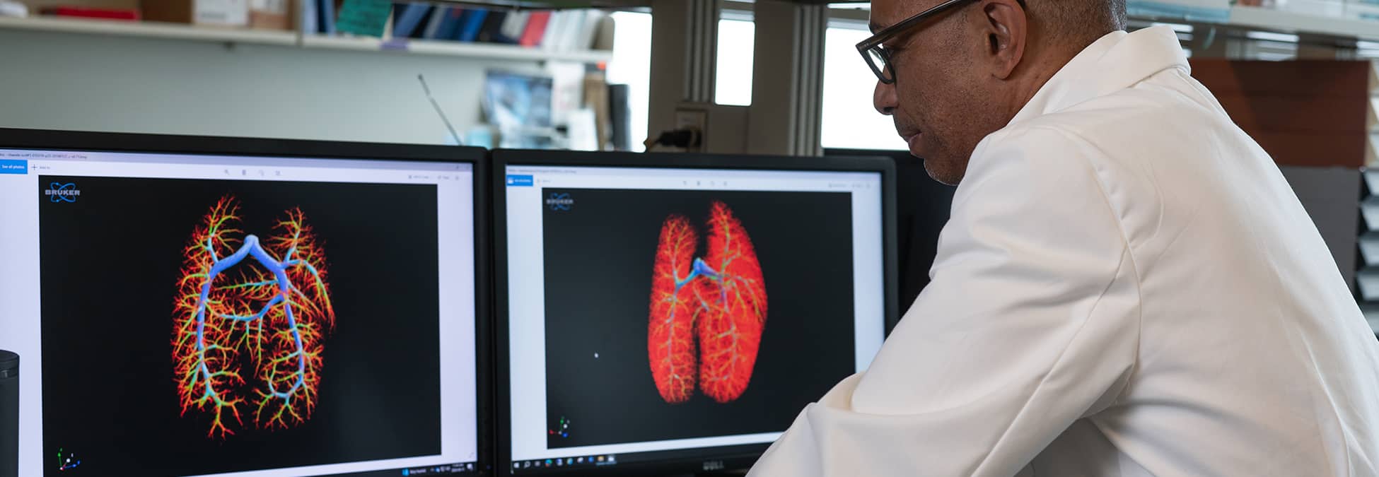 doctor looking at scans