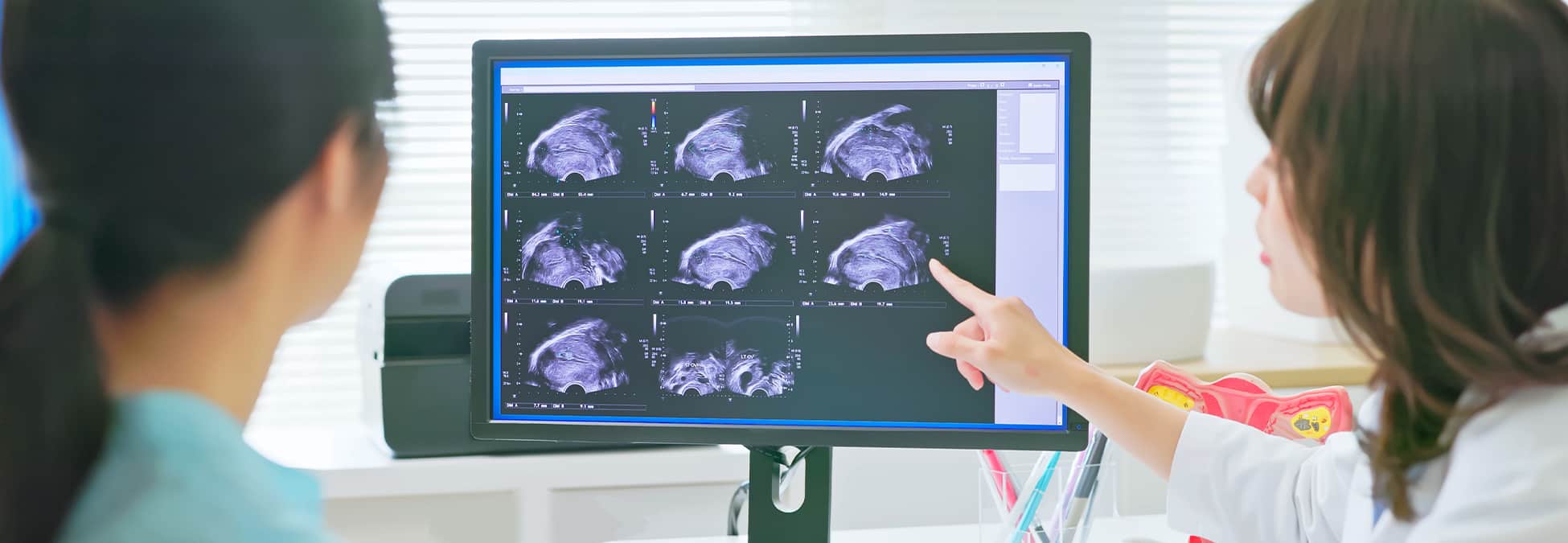Ovarian Cancer